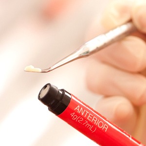A dentist using a dental instrument to extract composite resin from a tube