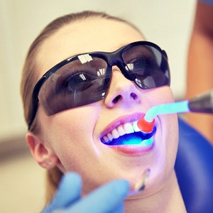 A young female in the dentist’s chair undergoing direct bonding while a curing light hardens the resin into place