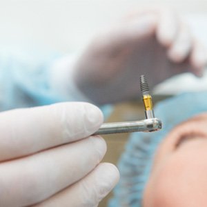 dentist performing dental implant surgery 