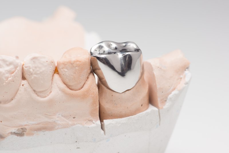 Closeup of a metal dental crown