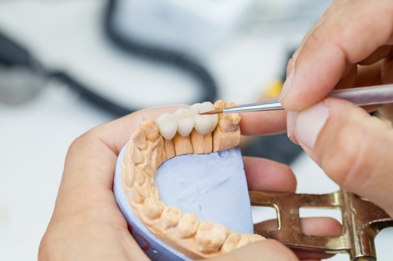 A technician working on dental crown lifespan
